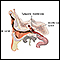Ear tube insertion - Series