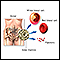 Bone-marrow transplant