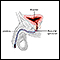 Urinary continence