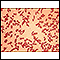 Red blood cells, sickle cells