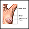 Breast anatomy